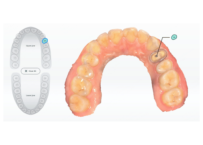 Aoralscan L Workflow